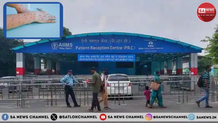 Monkeypox Virus Monkeypox Menace Vigilance & Preparedness